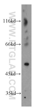 CTBS Antibody in Western Blot (WB)