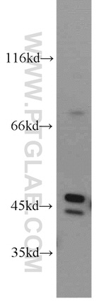 CTBS Antibody in Western Blot (WB)