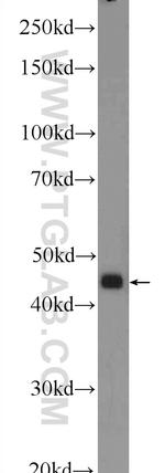 CTBS Antibody in Western Blot (WB)