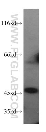 CTBS Antibody in Western Blot (WB)