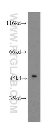 CTBS Antibody in Western Blot (WB)