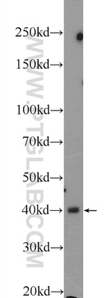 CTBS Antibody in Western Blot (WB)