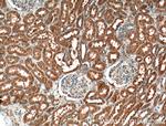 GCLC Antibody in Immunohistochemistry (Paraffin) (IHC (P))