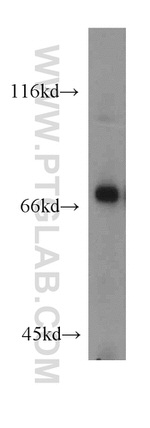 GCLC Antibody in Western Blot (WB)