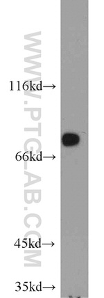 GCLC Antibody in Western Blot (WB)