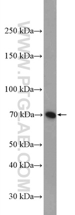 GCLC Antibody in Western Blot (WB)