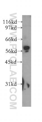 MAOB Antibody in Western Blot (WB)