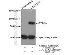 GUCY1A3 Antibody in Immunoprecipitation (IP)