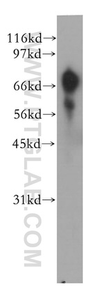 GUCY1A3 Antibody in Western Blot (WB)