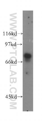 GUCY1A3 Antibody in Western Blot (WB)