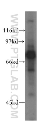 GUCY1A3 Antibody in Western Blot (WB)