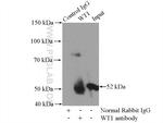 WT1 Antibody in Immunoprecipitation (IP)