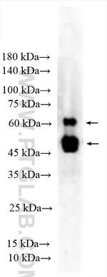 WT1 Antibody in Western Blot (WB)