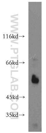 WT1 Antibody in Western Blot (WB)