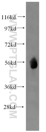 WT1 Antibody in Western Blot (WB)