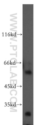 WT1 Antibody in Western Blot (WB)