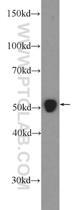 WT1 Antibody in Western Blot (WB)