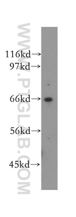 VPS45 Antibody in Western Blot (WB)