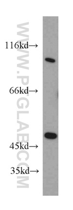 Cadherin-13 Antibody in Western Blot (WB)