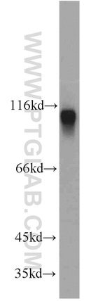 Cadherin-13 Antibody in Western Blot (WB)