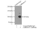 Cadherin-13 Antibody in Immunoprecipitation (IP)