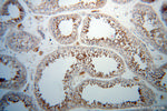 PABPC3 Antibody in Immunohistochemistry (Paraffin) (IHC (P))