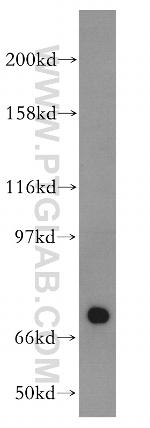 PABPC3 Antibody in Western Blot (WB)