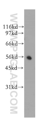 CYB5R4 Antibody in Western Blot (WB)