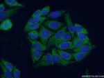 SUCLA2 Antibody in Immunocytochemistry (ICC/IF)