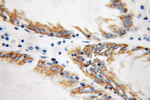 SUCLA2 Antibody in Immunohistochemistry (Paraffin) (IHC (P))