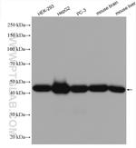 SUCLA2 Antibody in Western Blot (WB)