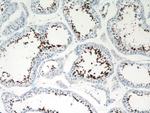 Calmegin Antibody in Immunohistochemistry (Paraffin) (IHC (P))