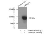 Calmegin Antibody in Immunoprecipitation (IP)