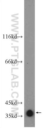 GNAO1 Antibody in Western Blot (WB)