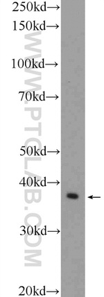 GNAO1 Antibody in Western Blot (WB)