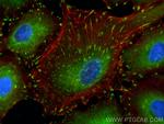 FAK Antibody in Immunocytochemistry (ICC/IF)