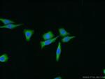 FAK Antibody in Immunocytochemistry (ICC/IF)