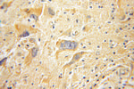 FAK Antibody in Immunohistochemistry (Paraffin) (IHC (P))