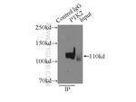 FAK Antibody in Immunoprecipitation (IP)