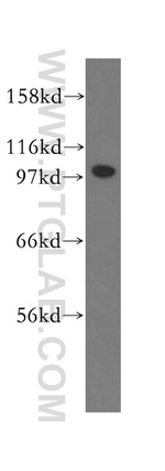 FAK Antibody in Western Blot (WB)