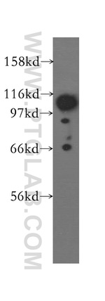 FAK Antibody in Western Blot (WB)