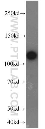 FAK Antibody in Western Blot (WB)