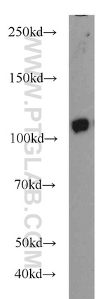 FAK Antibody in Western Blot (WB)