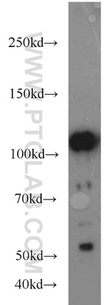 FAK Antibody in Western Blot (WB)