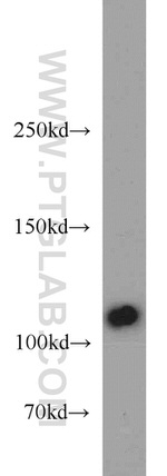 FAK Antibody in Western Blot (WB)