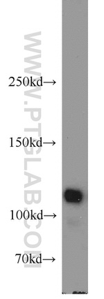 FAK Antibody in Western Blot (WB)