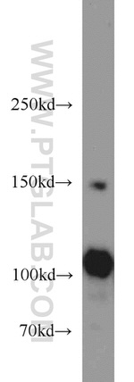 FAK Antibody in Western Blot (WB)