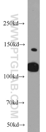 FAK Antibody in Western Blot (WB)