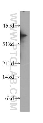 CIAPIN1 Antibody in Western Blot (WB)