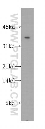 CIAPIN1 Antibody in Western Blot (WB)